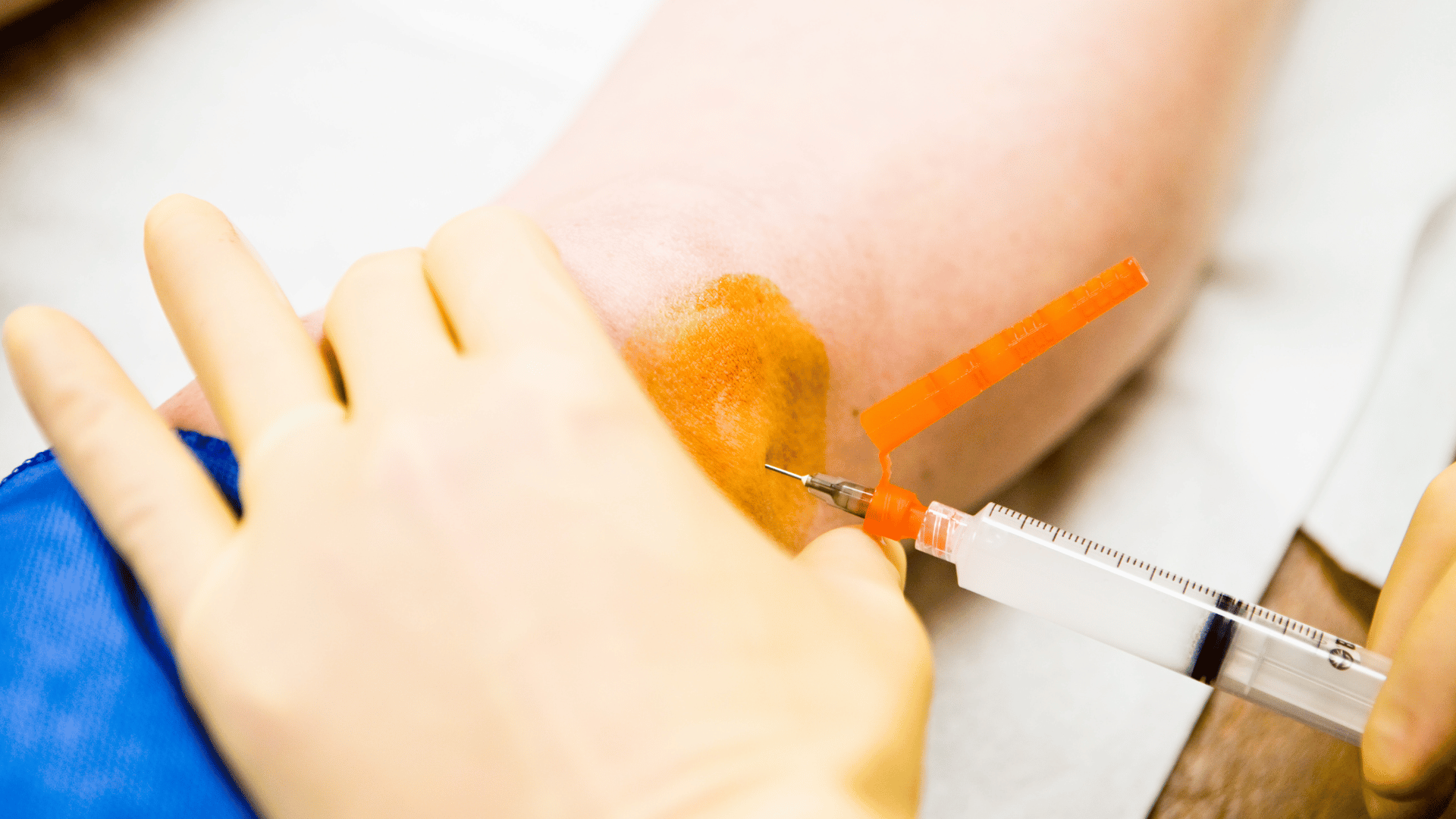 Injection de cortisone dans le genou : efficaces pour soulager la douleur?