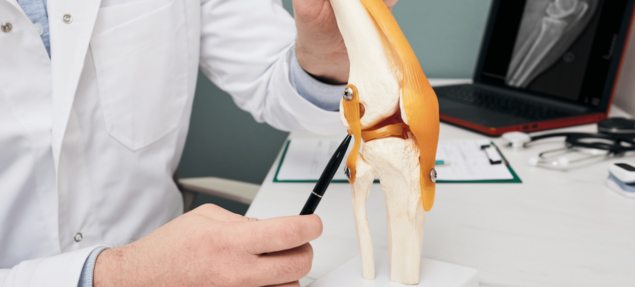 déchirure du ligament croisé antérieur (LCA)