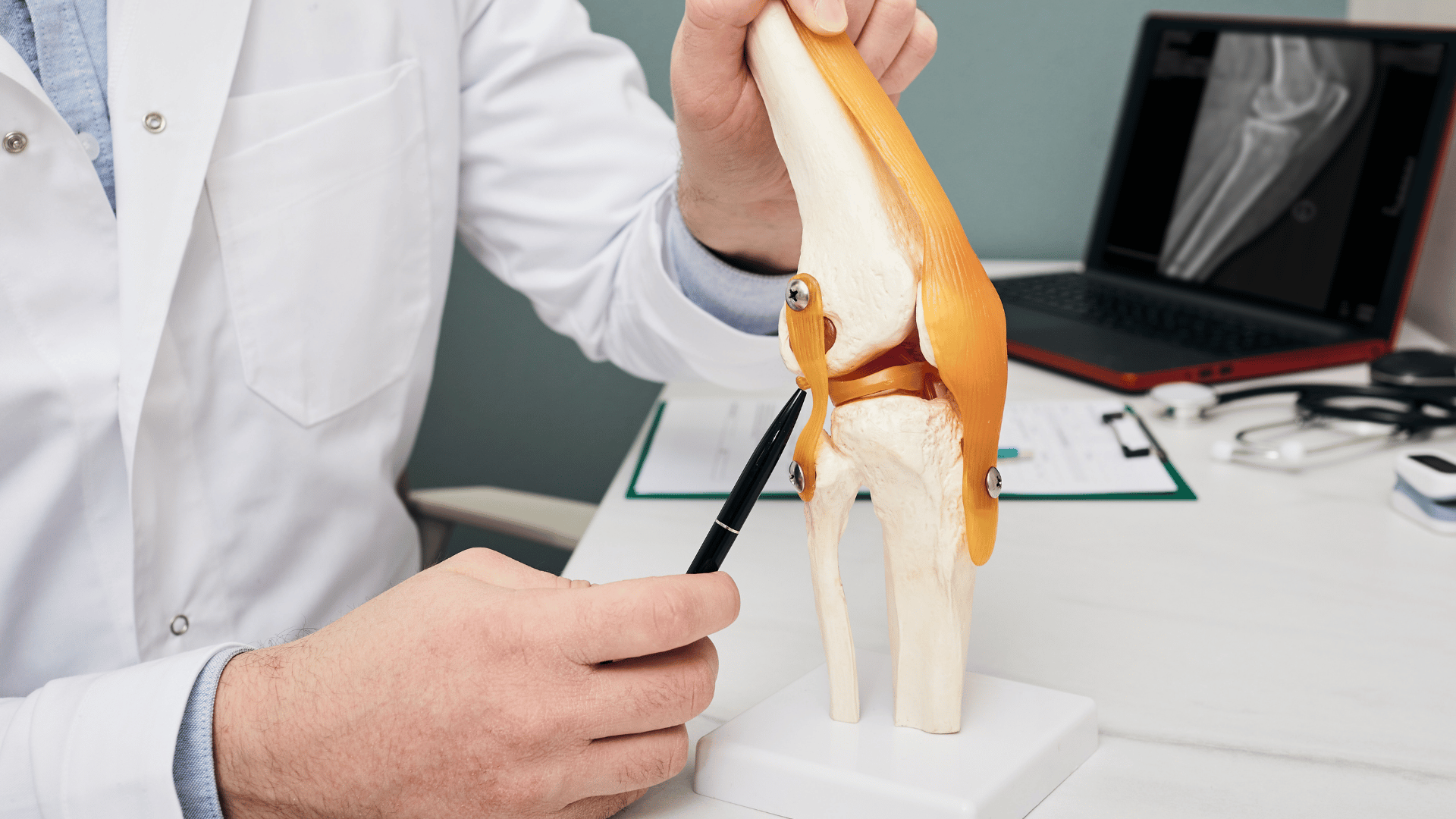 déchirure du ligament croisé antérieur (LCA)