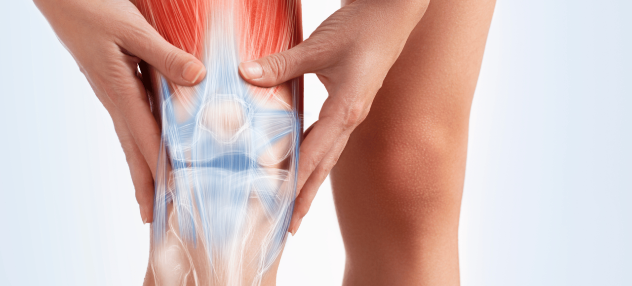 Arthrite rhumatoïde