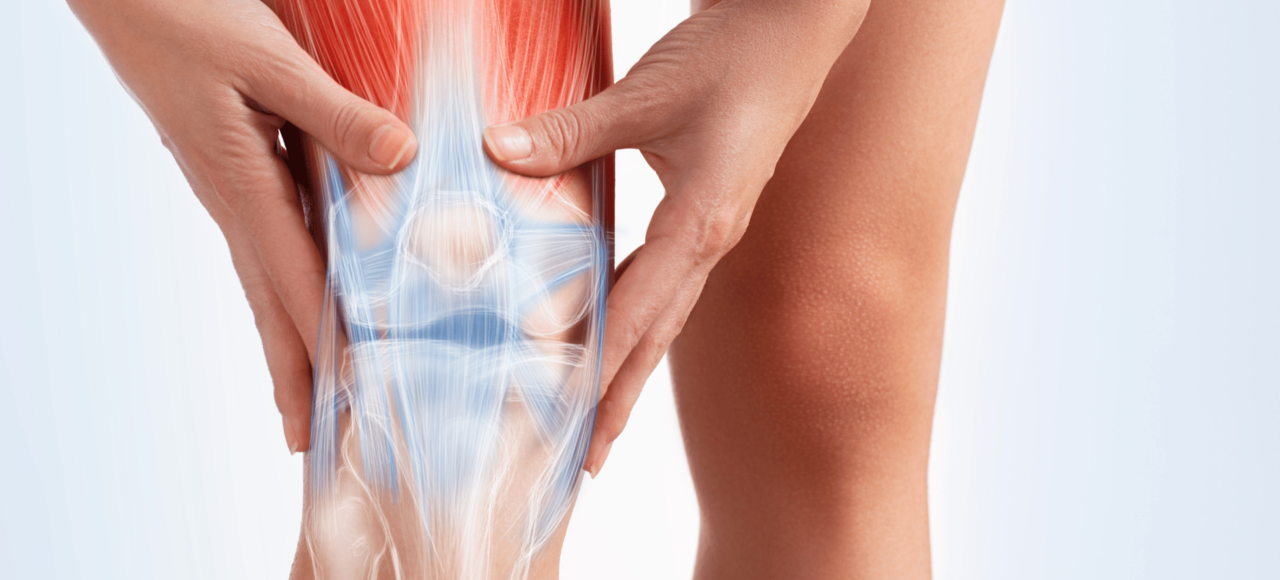 Rheumatoid Arthritis