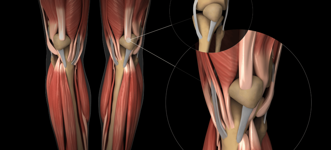 usure cartilage genou